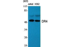 Western Blot (WB) analysis of specific cells using DR4 Polyclonal Antibody. (DR4 Antikörper  (C-Term))