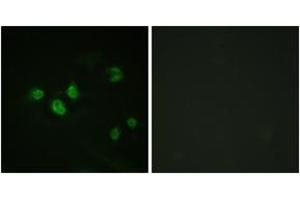 Immunofluorescence analysis of HeLa cells, using SP1 (Phospho-Thr453) Antibody. (SP1 Antikörper  (pThr453))