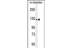 Western blot analysis in mouse bladder tissue lysates (35ug/lane).