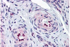 Human Uterus, Vessels (formalin-fixed, paraffin-embedded) stained with IL33 antibody ABIN343919 at 5 ug/ml followed by biotinylated goat anti-rabbit IgG secondary antibody ABIN481713, alkaline phosphatase-streptavidin and chromogen. (IL-33 Antikörper  (Internal Region))