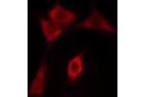 ABIN6275498 staining COLO205 cells by IF/ICC. (ARHGEF3 Antikörper  (C-Term))