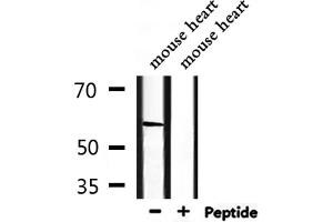 Western blot analysis of extracts from mouse heart, using PCTK2 Antibody. (CDK17 Antikörper  (Internal Region))