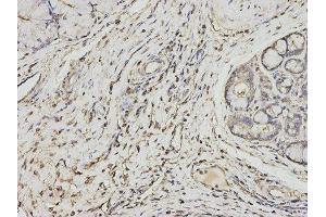 Immunohistochemistry (IHC) image for anti-Proteasome (Prosome, Macropain) Activator Subunit 1 (PA28 Alpha) (PSME1) antibody (ABIN1876546) (PSME1 Antikörper)