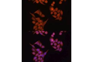 Immunofluorescence analysis of HeLa cells using OCLN antibody. (Occludin Antikörper  (AA 263-522))