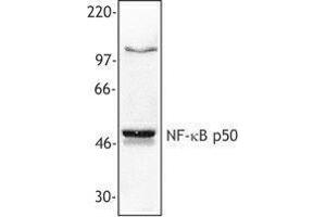 Western Blotting (WB) image for anti-Nuclear Factor kappa B p50 (NFkB p50) antibody (ABIN2666083) (Nuclear Factor kappa B p50 (NFkB p50) Antikörper)
