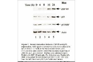 Image no. 2 for anti-Zinc Finger Protein 148 (ZNF148) antibody (ABIN117932) (ZNF148 Antikörper)