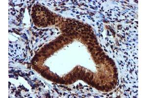 Image no. 9 for anti-EPM2A (Laforin) Interacting Protein 1 (EPM2AIP1) antibody (ABIN1498045) (EPM2AIP1 Antikörper)