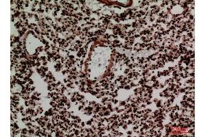 Immunohistochemistry (IHC) analysis of paraffin-embedded Mouse Lung, antibody was diluted at 1:100. (FOXP1 Antikörper  (C-Term))