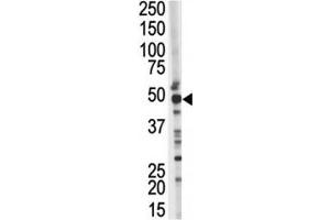 Western blot testing of TSG101 antibody and mouse kidney tissue lysate. (TSG101 Antikörper  (AA 1-30))