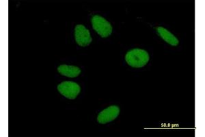 Immunofluorescence of purified MaxPab antibody to ZNF43 on HeLa cell. (ZNF43 Antikörper  (AA 1-803))
