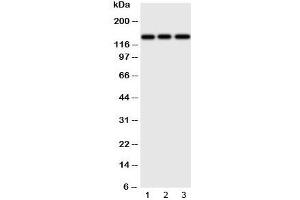 Western blot testing of ERBB4 antibody and Lane 1:  human HeLa;  2: (h) U87;  3: mouse Neuro-2a cell lysate. (ERBB4 Antikörper  (N-Term))