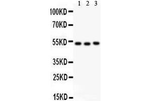 Anti- Factor VII antibody, Western blotting All lanes: Anti Factor VII  at 0. (Factor VII Antikörper  (C-Term))
