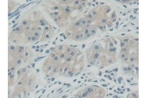 Immunohistochemistry (IHC) image for anti-Receptor Tyrosine Kinase-Like Orphan Receptor 2 (ROR2) (AA 683-934) antibody (ABIN7443737)