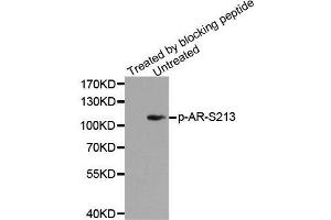 Western blot analysis of extracts from DU145 cells using Phospho-AR-S213 antibody. (Androgen Receptor Antikörper  (pSer213))
