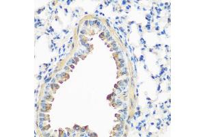 Immunohistochemistry of paraffin-embedded mouse lung using CAV3 antibody (ABIN5974782) at dilution of 1/200 (40x lens). (Caveolin 3 Antikörper)