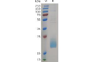 CD3d Molecule, delta (CD3-TCR Complex) (CD3D) (AA 22-105) protein (His tag)