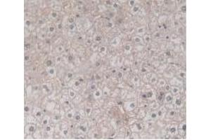 Immunohistochemistry (IHC) image for anti-Transmembrane Protein 27 (TMEM27) (AA 17-137) antibody (ABIN7427249)