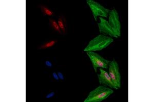 ABIN6263316 and ABIN6278007 staining  cells by IF/ICC. (MNX1 Antikörper  (C-Term))