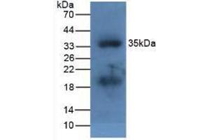 Figure. (APOA5 Antikörper  (AA 21-210))