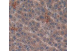 IHC-P analysis of Rat Tissue, with DAB staining. (SULT1A1 Antikörper  (AA 3-291))