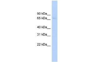 WB Suggested Anti-ABCF2 Antibody Titration:  0. (ABCF2 Antikörper  (Middle Region))