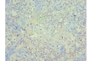 Immunohistochemistry of paraffin-embedded human tonsil tissue using ABIN7150963 at dilution of 1:100 (PIAS1 Antikörper  (AA 422-651))