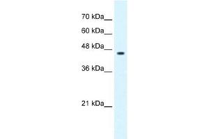 GLIS3 antibody used at 0. (GLIS3 Antikörper  (C-Term))