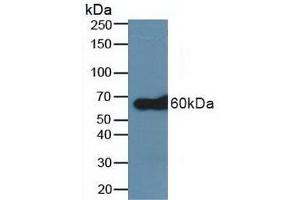 Detection of TRAF6 in Human A431 Cells using Polyclonal Antibody to TNF Receptor Associated Factor 6 (TRAF6) (TRAF6 Antikörper  (AA 153-423))