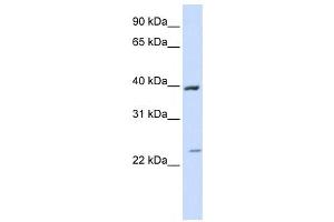 Western Blotting (WB) image for anti-Acyl-CoA Dehydrogenase, Long Chain (ACADL) antibody (ABIN2458052) (ACADL Antikörper)