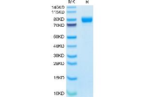 IL1RAP Protein (AA 21-359) (Fc Tag)