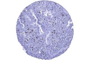 anti-Neural Cell Adhesion Molecule 1 (NCAM1) antibody