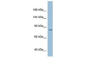 Western Blot showing KPNB1 antibody used at a concentration of 1 ug/ml against ACHN Cell Lysate (KPNB1 Antikörper  (N-Term))