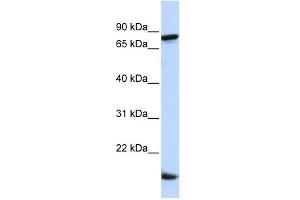 WB Suggested Anti-ZNF281 Antibody Titration:  0. (ZNF281 Antikörper  (Middle Region))