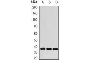 Western blot analysis of ALKBH3 expression in HepG2 (A), Hela (B), MCF7 (C) whole cell lysates. (ALKBH3 Antikörper)