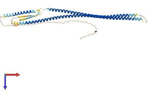 KRT17 Protein (AA 1-433) (His tag)