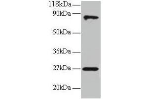 Western blot All lanes: RPL17 antibody at 2 μg/mL + EC109 whole cell lysate Secondary Goat polyclonal to rabbit IgG at 1/15000 dilution Predicted band size: 22, 18, 27 kDa Observed band size: 27, 80 kDa (RPL17 Antikörper  (AA 2-184))