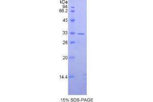 SDS-PAGE analysis of Human AXIN2 Protein. (AXIN2 Protein)