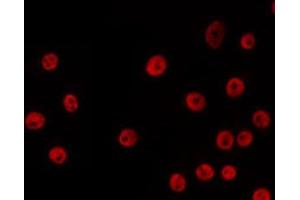 ABIN6266672 staining HeLa by IF/ICC. (USF2 Antikörper  (Internal Region))