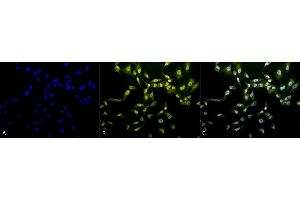 Immunocytochemistry/Immunofluorescence analysis using Rabbit Anti-Phosphothreonine Polyclonal Antibody (ABIN361757). (Phosphothreonine Antikörper)