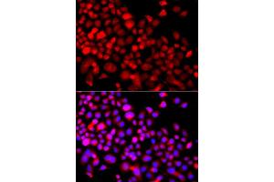 Immunofluorescence analysis of A549 cell using CALCOCO1 antibody. (CALCOCO1 Antikörper)