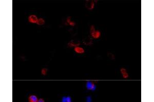 Immunofluorescence analysis of HeLa cells using FLNB Polyclonal Antibody at dilution of 1:100 (40x lens).