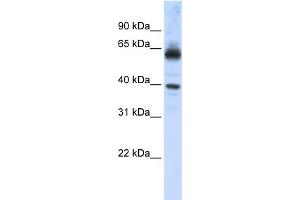WB Suggested Anti-KPNA1 Antibody Titration: 0. (KPNA1 Antikörper  (N-Term))