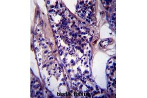 Immunohistochemistry (IHC) image for anti-Coiled-Coil Domain Containing 99 (CCDC99) antibody (ABIN2997362)