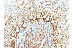 Formalin-fixed, paraffin-embedded human Cerebellum stained with Neurofilament Mouse Monoclonal Antibody (NE14). (NEFH Antikörper)