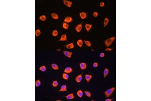 Immunofluorescence analysis of L929 cells using SCYL2 Rabbit pAb (ABIN6132636, ABIN6147463, ABIN6147465 and ABIN6217078) at dilution of 1:100. (SCYL2 Antikörper  (AA 1-300))