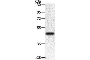 Western blot analysis of Mouse heart tissue, using PDK2 Polyclonal Antibody at dilution of 1:500 (PDK2 Antikörper)