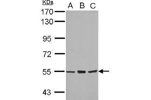 WB Image Sample (30 ug of whole cell lysate) A: A549 B: H1299 C: MCF-7 7. (CYP4B1 Antikörper  (Center))
