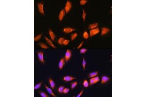Immunofluorescence analysis of U2OS cells using SCYL2 Rabbit pAb (ABIN6132636, ABIN6147463, ABIN6147465 and ABIN6217078) at dilution of 1:100. (SCYL2 Antikörper  (AA 1-300))