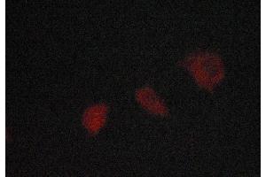 Immunofluorescence (fixed cells) (IF/ICC) image for anti-Spleen tyrosine Kinase (SYK) (pTyr323) antibody (ABIN6256708)
