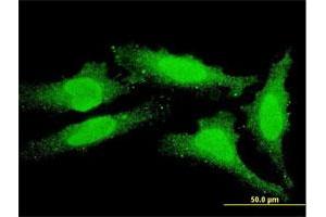 Immunofluorescence of monoclonal antibody to FOXO1 on HeLa cell. (FOXO1 Antikörper  (AA 556-655))